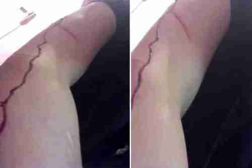 شاهد: فتاة سعودية تكشف تفاصيل تعرضها للضرب من قبل والدها.. وتصور ذراعها وهو ينزف