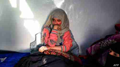 مأساة فتاة يمنية احرقها زوجها بالاسيد وهو يضحك (تفاصيل مؤلمة)