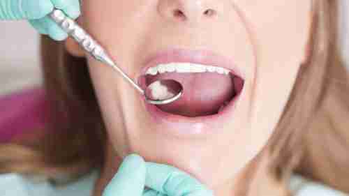 حالات تصيب الفم قد تكون تنبيها على حالة صحية أكثر خطورة