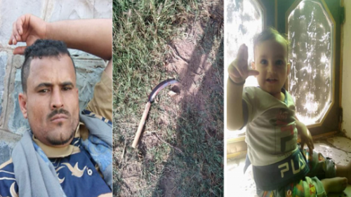 يمني يذبح طفلة أبن الـ 3 سنوات بالشريم من أجل تأديب زوجته 