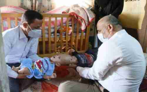 وكيل حضرموت يناشد "مركز سلمان" لإنقاذ حياة الطفلين السيامين " يوسف و ياسين "