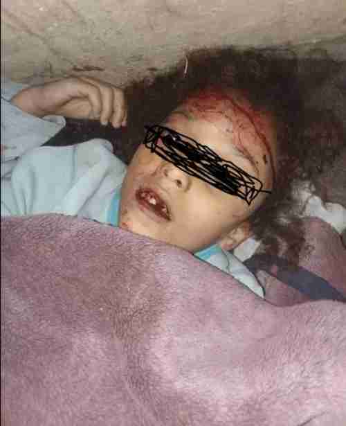 أب يمني من محافظة إب يقتل طفلته في أول أيام شهر رمضان " صورة" 