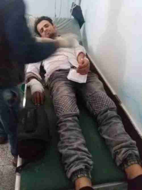 بالصور .. إصابة الإعلامي ماجد الشعيبي برصاص مليشيا الحوثي في قعطبة
