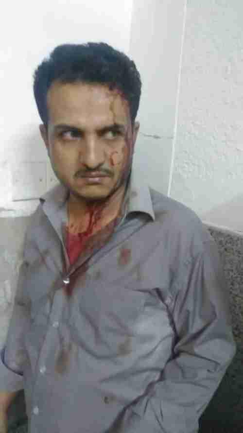 مشرف حوثي يعتدي بالضرب على طاقم مركز غسيل الكلى بمستشفى الثورة صنعاء 