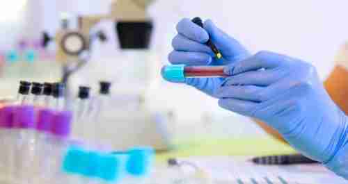 اختبار دم بسيط يمنح أملاً لمرضى السرطان