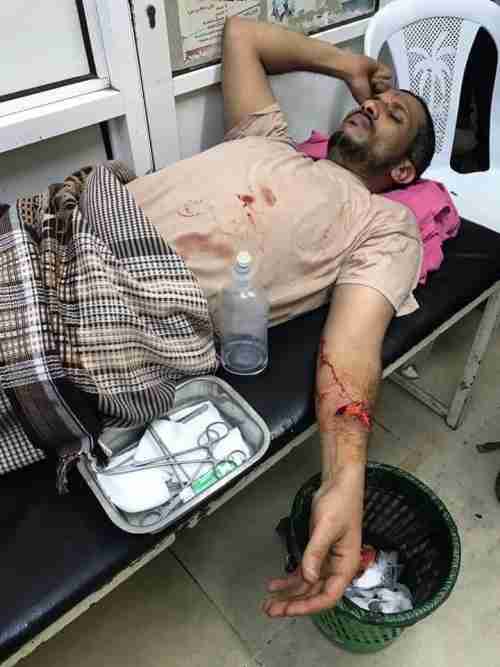 صورة من المستشفى:   اصابة العميد مهران القباطي