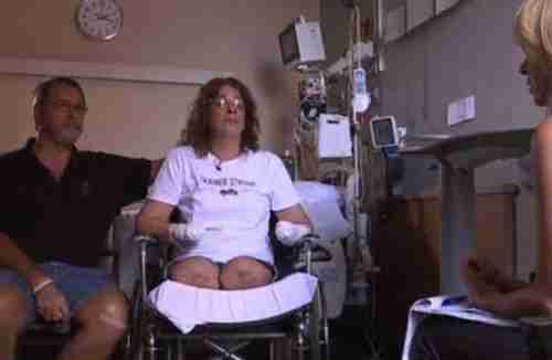 من قصة حب إلى كابوس .. بترت أطرافها الأربعة !