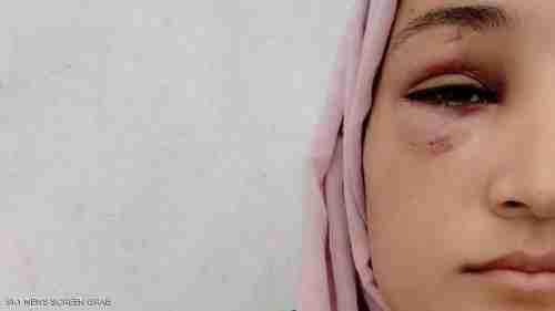 مأساة جديدة في غزة.. اعتداء وحشي على فتاة والفاعل شقيقها