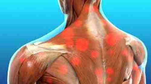ما هو الألم اللفافي العضلي المزمن؟.. الأسباب والعلاج