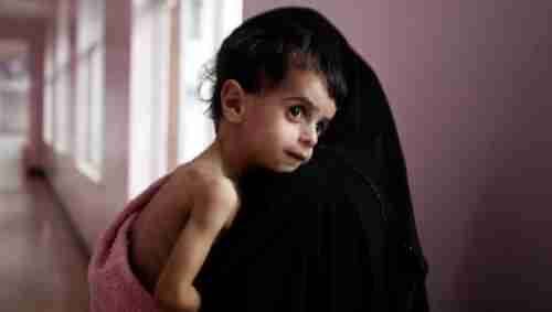  تقرير: أكثر من نصف قتلى صراع اليمن أطفال ونساء