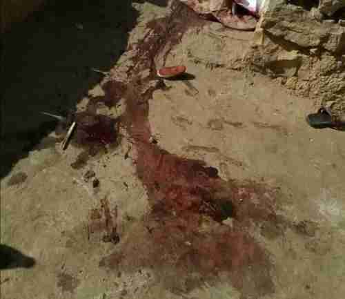 في جريمة هزت المحافظة.. مقتل امرأة على يد زوجها في المحويت