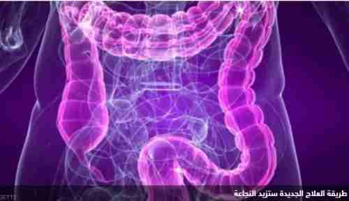 "اكتشاف" يبشر بتحول كبير في علاج التهاب الأمعاء