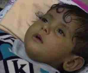 مستشفى في تعز يسرق بصر الطفلة "سدرة الدبعي"