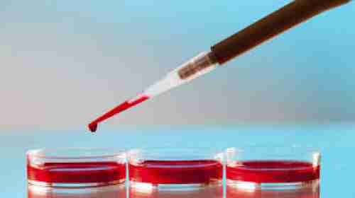 دراسة تكشف فصيلة الدم التي تتنبأ بخطر الإصابة بمرض فيروسي قاتل