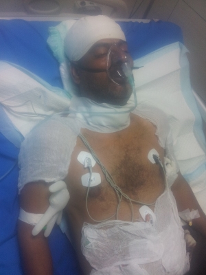 شاهد اول صورة له في العناية المركزة: حادث سير أرقده في العناية المركزة.."عبدالهادي باحزيم" ينظر الى الله ويحتاج الى وقوف الجميع بجانبه !!