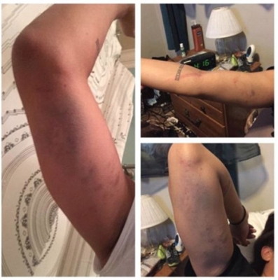 صورة سيلفي تكشف تورط لاعب أميركي بجريمة اعتداء