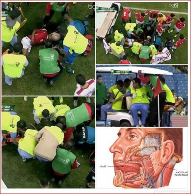 كيف يبلع اللاعب لسانه في ملاعب كرة القدم .. وماهو العلاج ؟! .. بقشان لم يصب بذلك !!