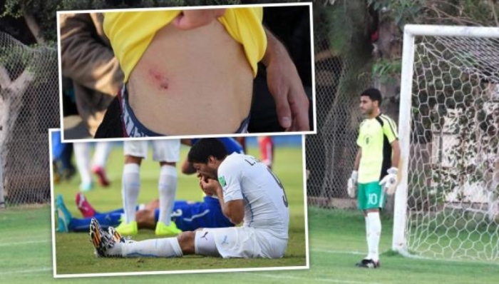 في سنة القحص: لاعب فلسطيني يعضّ منافسه..على طريقة سواريز !!