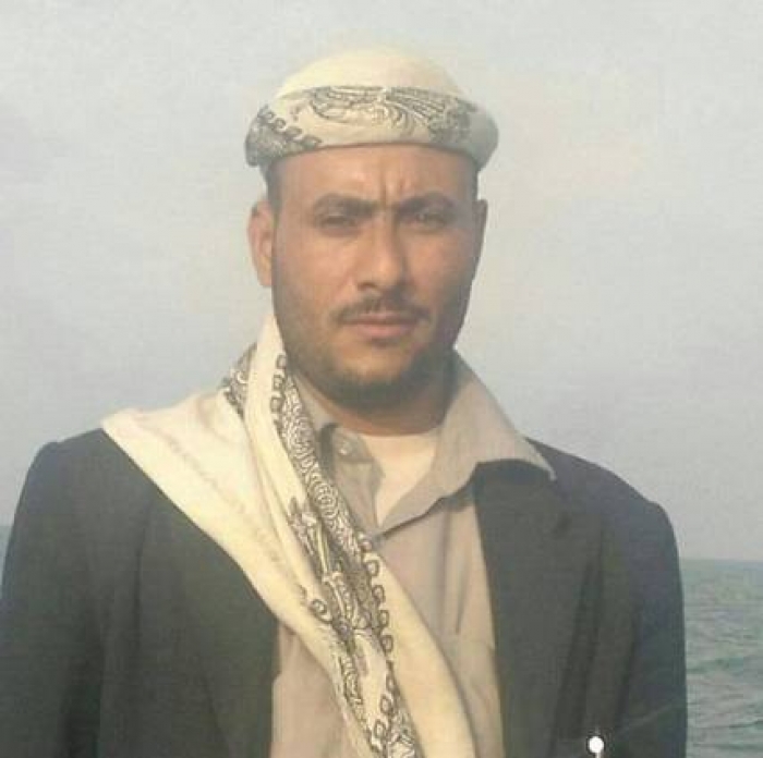 الحوثيون يعذبون احد الشباب حتى الموت "صورة"