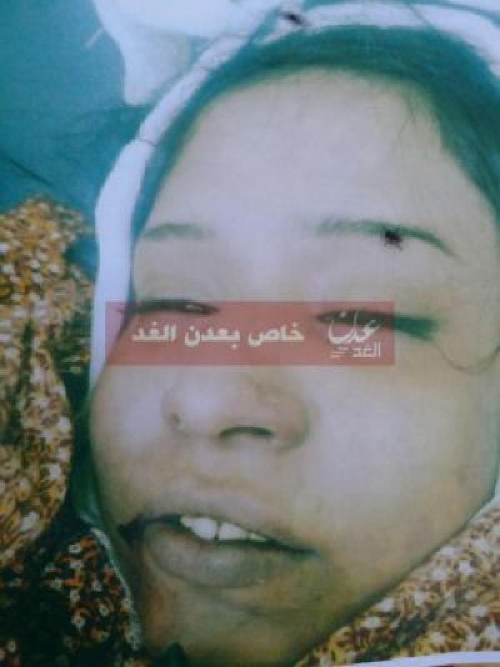 سلطات عدن تخرج مذيعة من قبرها بعد وفاتها بـ 4 أشهر