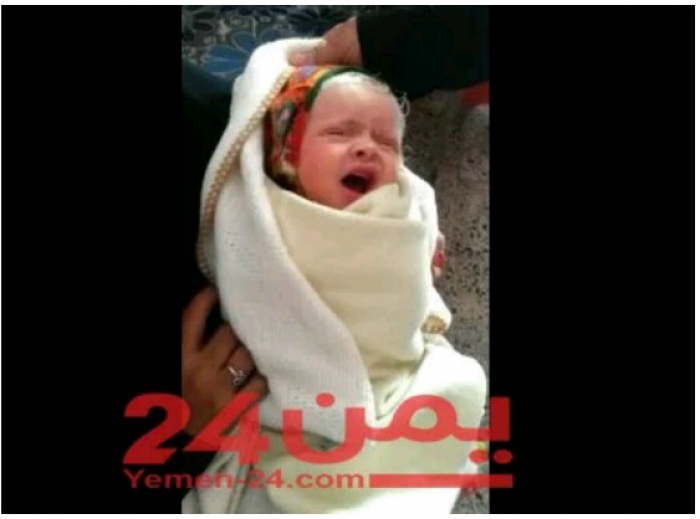 شاهد ماذافعلت الحرب باليمن .. طفلة تخلق شيبة