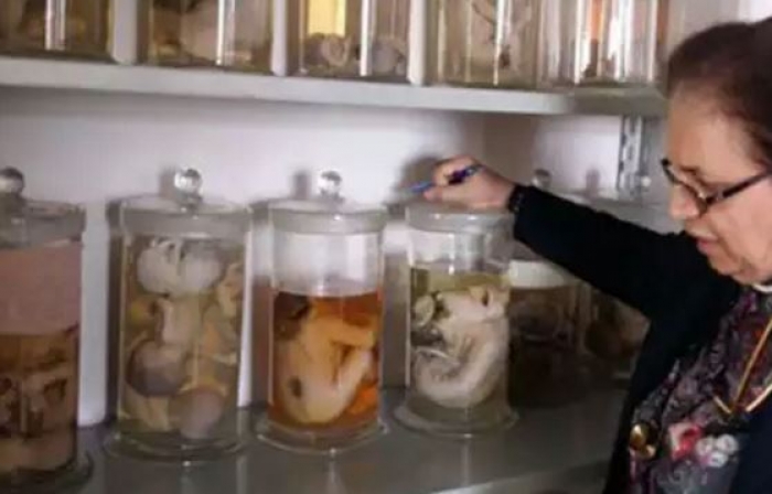 طبيبة تحتفظ بـ 122 جثة تعود لأطفال كورد