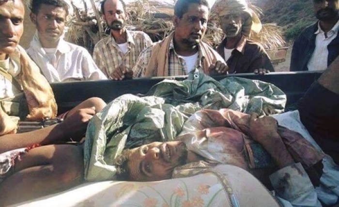 مصرع القيادي الحوثي ابو حرب في تعز .. صــورة