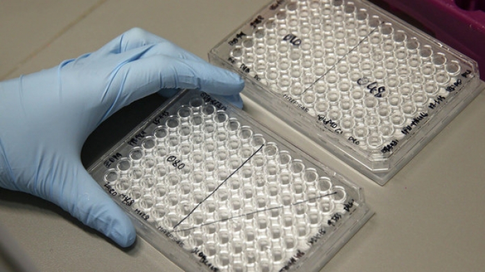 الصحة العالمية: إيبولا في غينيا انتهى