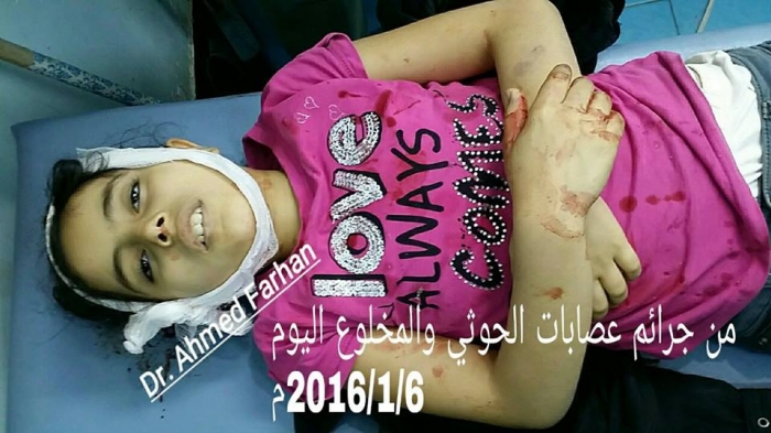مجزرة جديدة يرتكبها الحوثيون بحق أطفال تعز