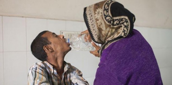 مرض نادر يحول أيدي بنجلاديشي إلى جذع شجرة (صور)