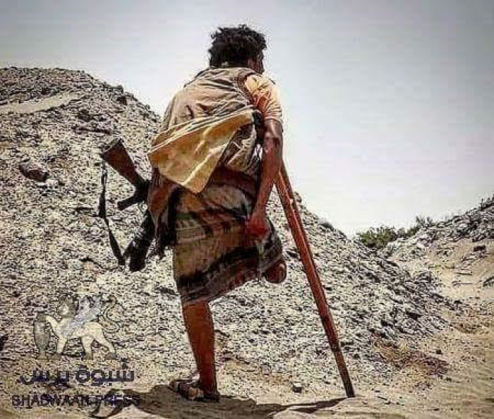 من هو "سيلفر الجنوب" الذي شغل قنوات وصحافة العالم وهو يقاتل على قدم واحدة (حوار خاص) ؟َ!