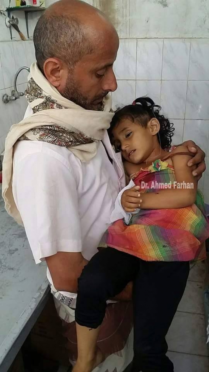 مليشيا الحوثي تواصل الانتقام من «تعز» بقصف الأحياء السكنية ومقتل 37 مسلح بين الطرفين .. صورة محزنة