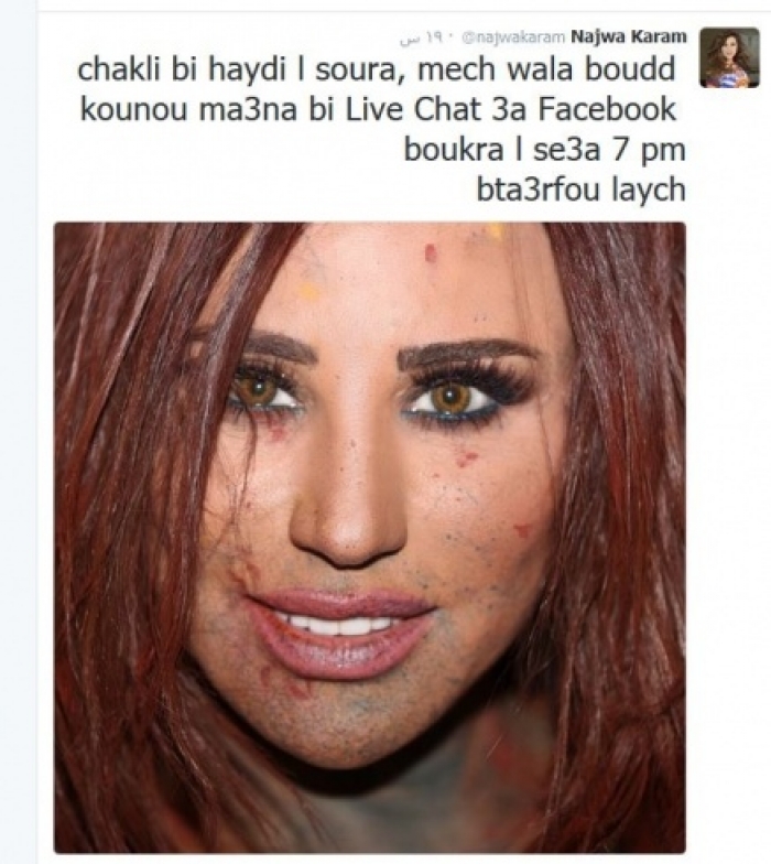 ماذا حصل لوجه نجوى كرم.. ولماذا تم نشر الصورة؟