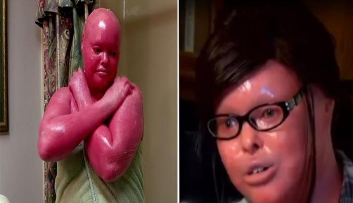 هذه المرأة ولدت مصابة بمرض نادر. لكنها حققت 3 معجزات في خلال 20 سنة !