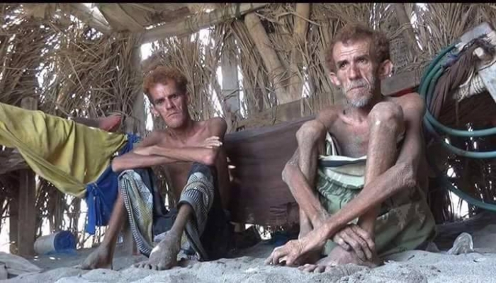 #شاهد صورة مؤلمة .. الجوع يفتك بأبناء تهامة ومناشدات عاجلة لتخليصهم من الإنقلاب وتبعاته