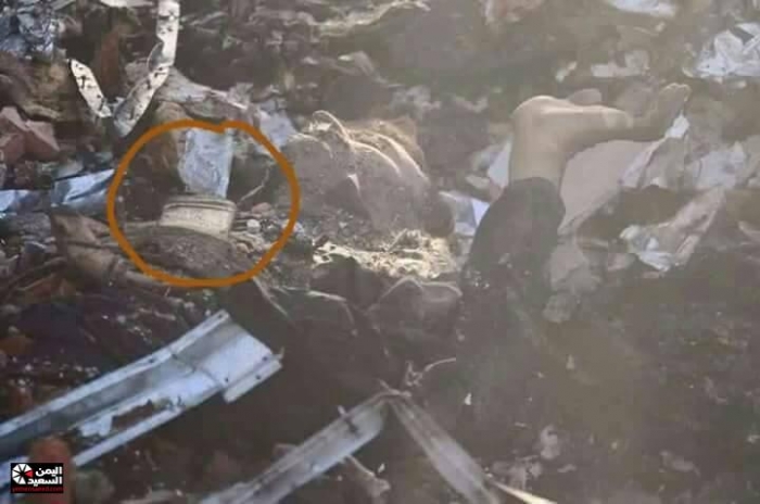 شاهد "صورة" حصرية  لما حدث للمصابين بعد انفجار قاعة العزاء بالعاصمة صنعاء