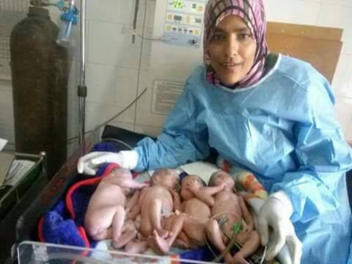 شاهد الصورة : سيدة من الضالع تلد اربع بنات توأم