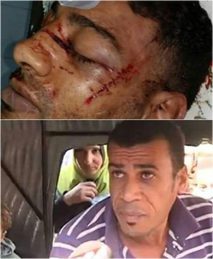 شاهد بالصورة : حقيقة مقتل سائق التوك توك المصري