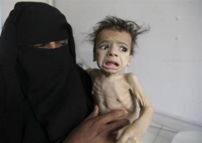 الحرب تقسو على أفقر فقراء اليمن