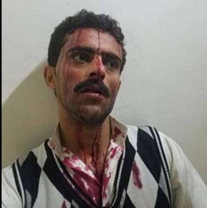 صورة وحدث: ناشط مقرب من صالح يتعرض للاختطاف والضرب المبرح من الحوثيين في صنعاء