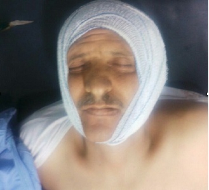 شاهد بالصورة مقتل عميد بمحافظة إب بسبب نزاع على قطعة أرض!