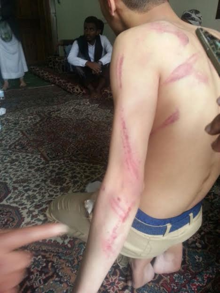 صورة : وزير التربية لملس يتوعد بمحاسبته مدير مدرسة بصنعاء يضرب أحد الطلاب بطريقة هستيرية