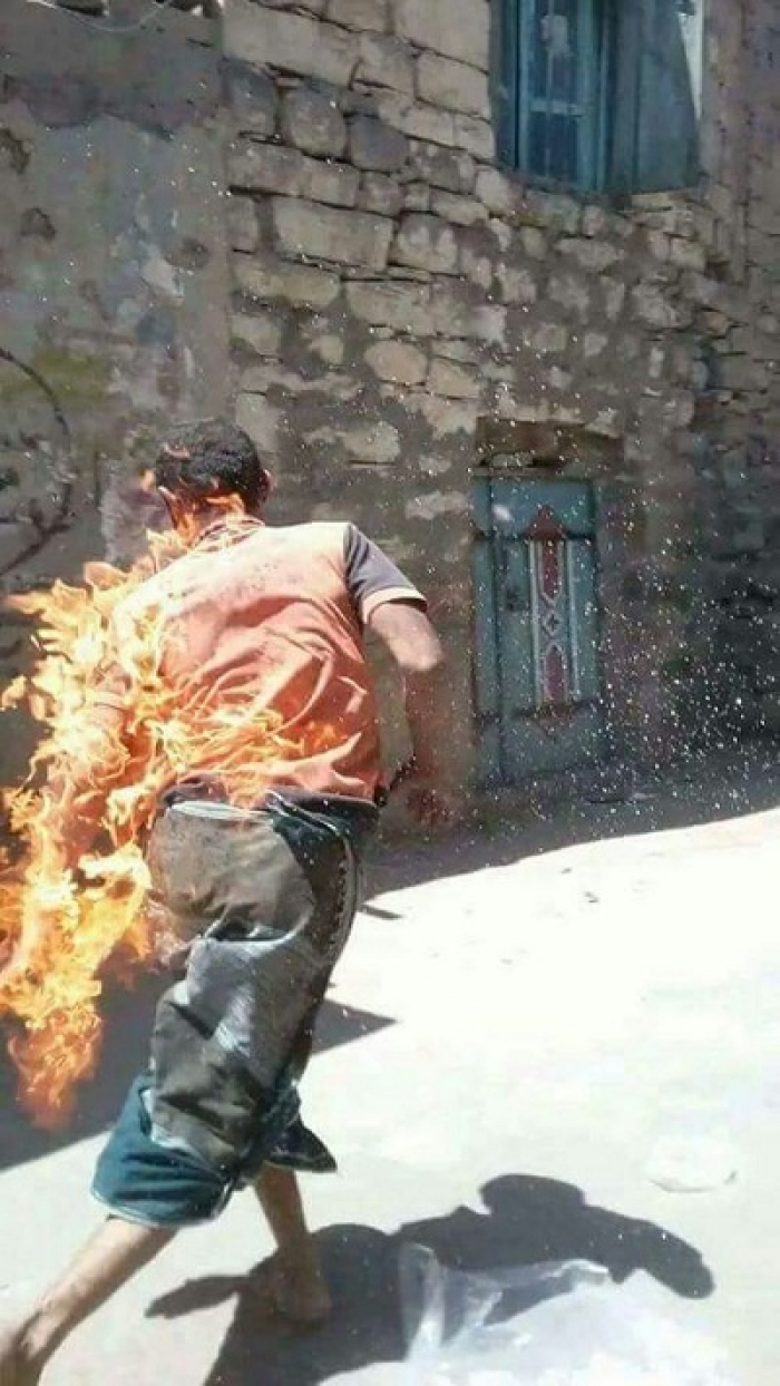شاهد كيف تم احراق شاب مختل عقليا في اب وسط اليمن ( صور )