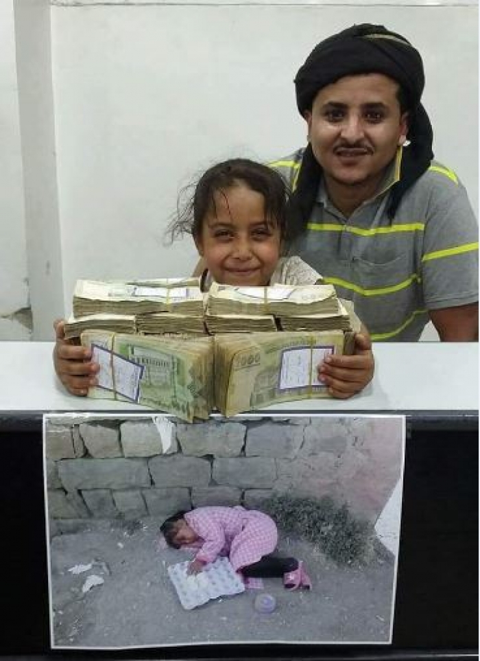 الطفلة اليمنية اميمة "بائعة البيض" تحصل على مليون ريال يمني (صور)