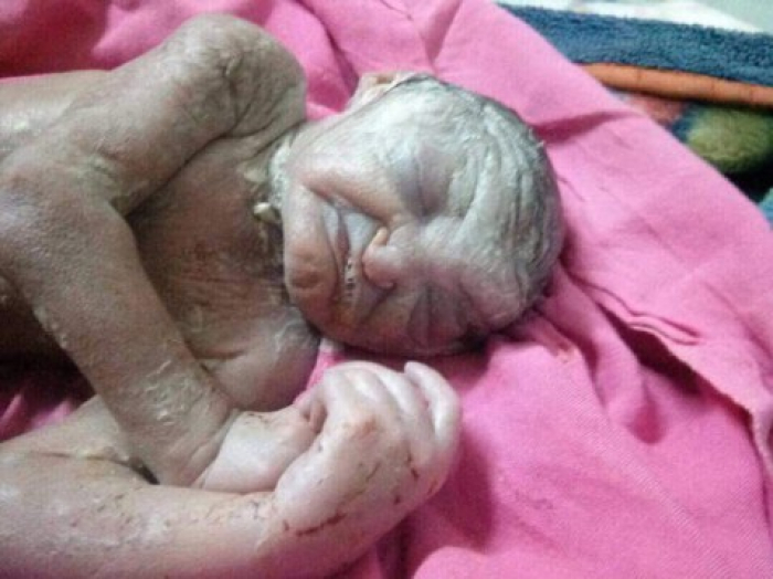 بالصور..ولادة طفل بصنعاء في الـ90 من عمره.. وردّة فعل أمه تكشف قسوة الصدمة !! (شاهد)