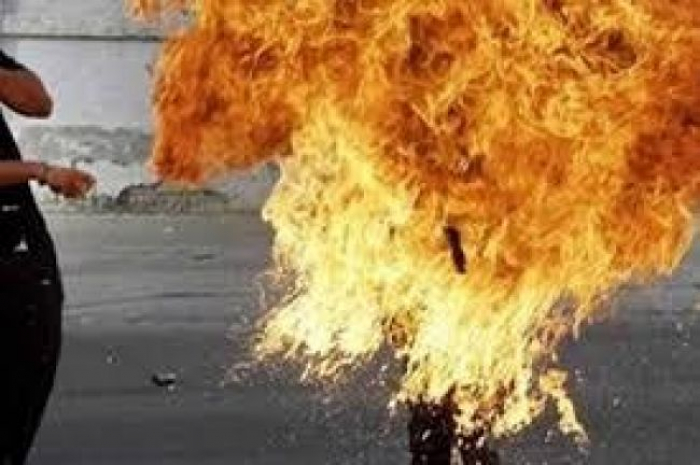 مواطن يمني يحرق نفسه وسط الشارع في صنعاء