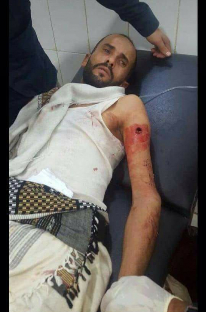 نجاة قيادي بمقاومة الضالع من محاولة اغتيال صباح اليوم .. صورة