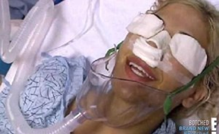 بالصور.. إمرأة تجري 13 عملية جراحية لتشبه إيفانكا ترامب!!