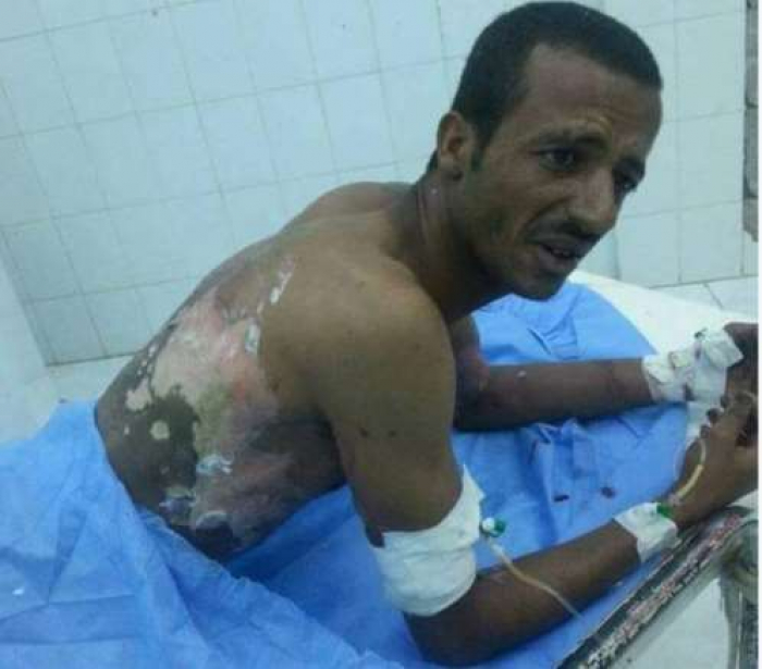 جندي يضرم النار في جسده بمدينة مأرب ..صورة
