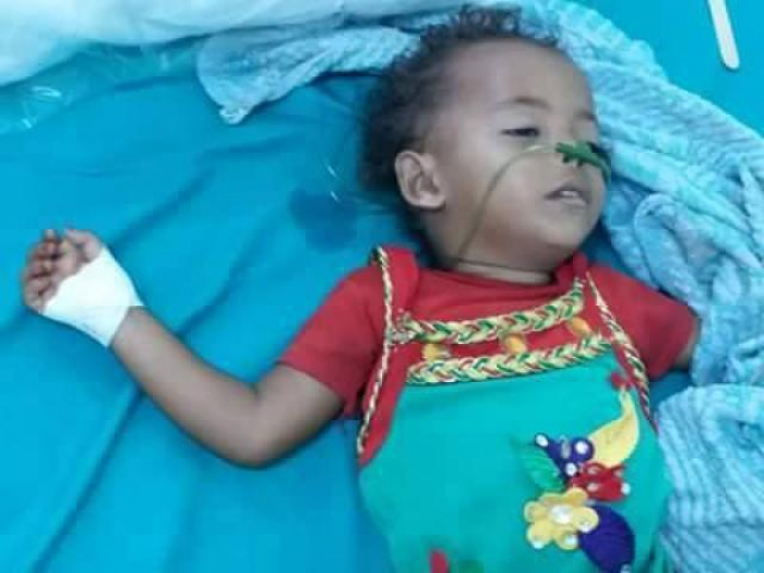 بعد "24 ساعة" من وفاة الطفلة ياسمين.. وفاة الطفلة ريحان اختناقا بوباء الدفتيريا في محافظة الحديدة (تفاصيل)